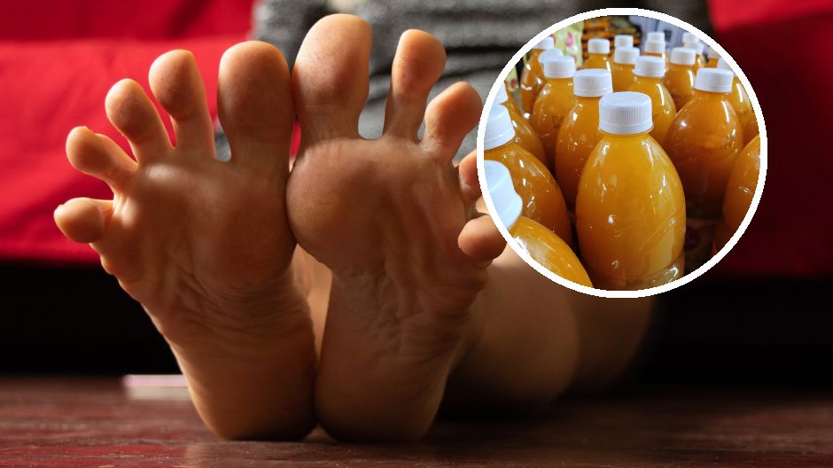 Napoje bogate w puryny mogą przyczyniać się do dny moczanowej