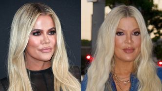 Tori Spelling komentuje porównania swojej nowej twarzy do Khloe Kardashian. "Jestem zaszczycona"