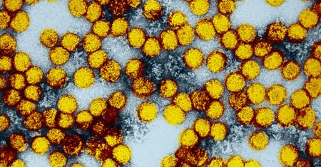 WHO przekazała straszne wieści. Nowa epidemia. Już 172 zgony