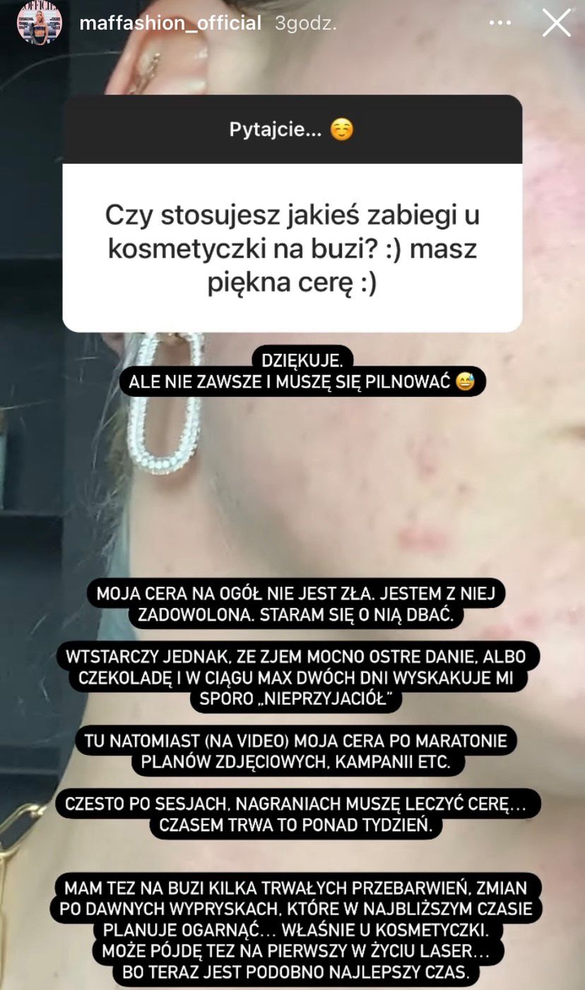 Maffashion pokazała niedoskonałości