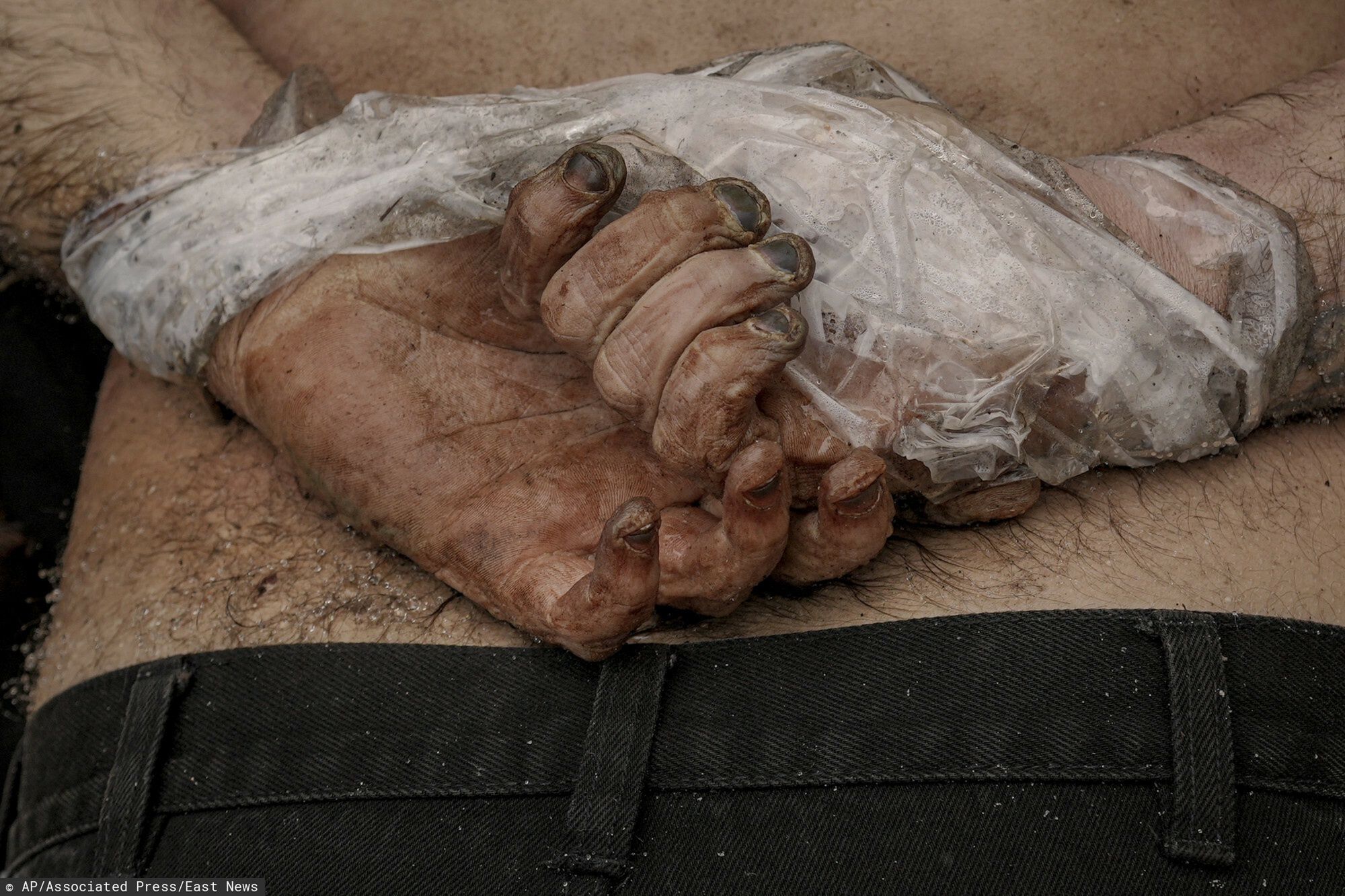 Wojna w Ukrainie - masakra cywil�w w BuczyA lifeless body of a man with his hands tied behind his back lies on the ground in Bucha, Ukraine, Sunday, April 3, 2022. Associated Press journalists in Bucha, a small city northwest of Kyiv, saw the bodies of at least nine people in civilian clothes who appeared to have been killed at close range. At least two had their hands tied behind their backs. (AP Photo/Vadim Ghirda)AP