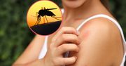 Komary szczególnie cię lubią? Wystarczy zmienić mydło