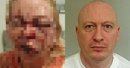 On ją skatował. Tym zdjęciem ofiara ostrzega przed przemocą domową