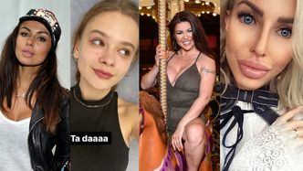 Julia Wróblewska, Natalia Siwiec i Anella, czyli galeria POWIĘKSZONYCH UST polskich celebrytek! (ZDJĘCIA)