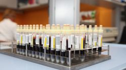 Czy grupa krwi może zwiększać ryzyko rozwoju niektórych chorób?