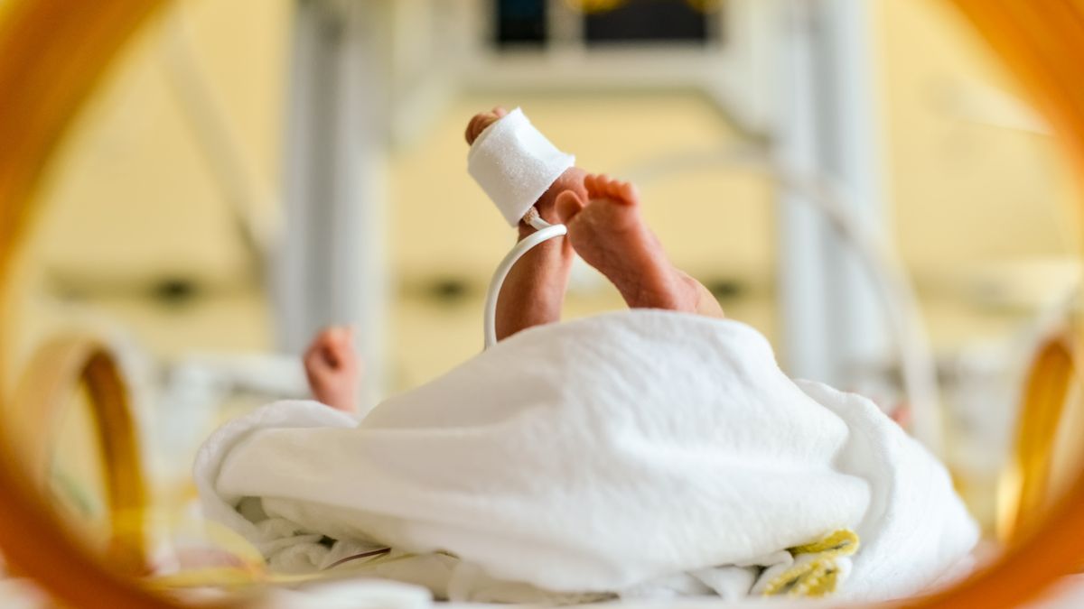 Arlekin - płód. Co to za choroba?