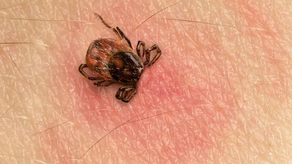 Harcerz z Poznania miał 62 kleszcze na ciele