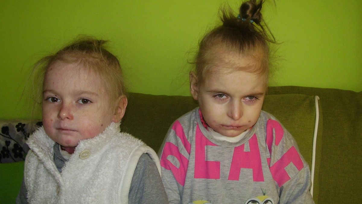 Skóra delikatna jak płatki róż