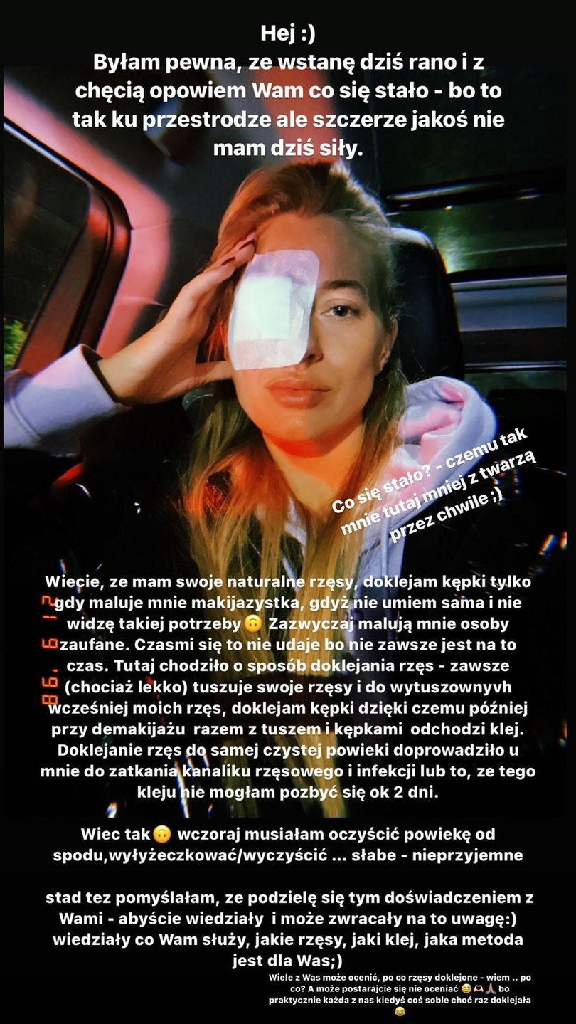 Marcelina Zawadzka trafiła do szpitala przez doklejone rzęsy