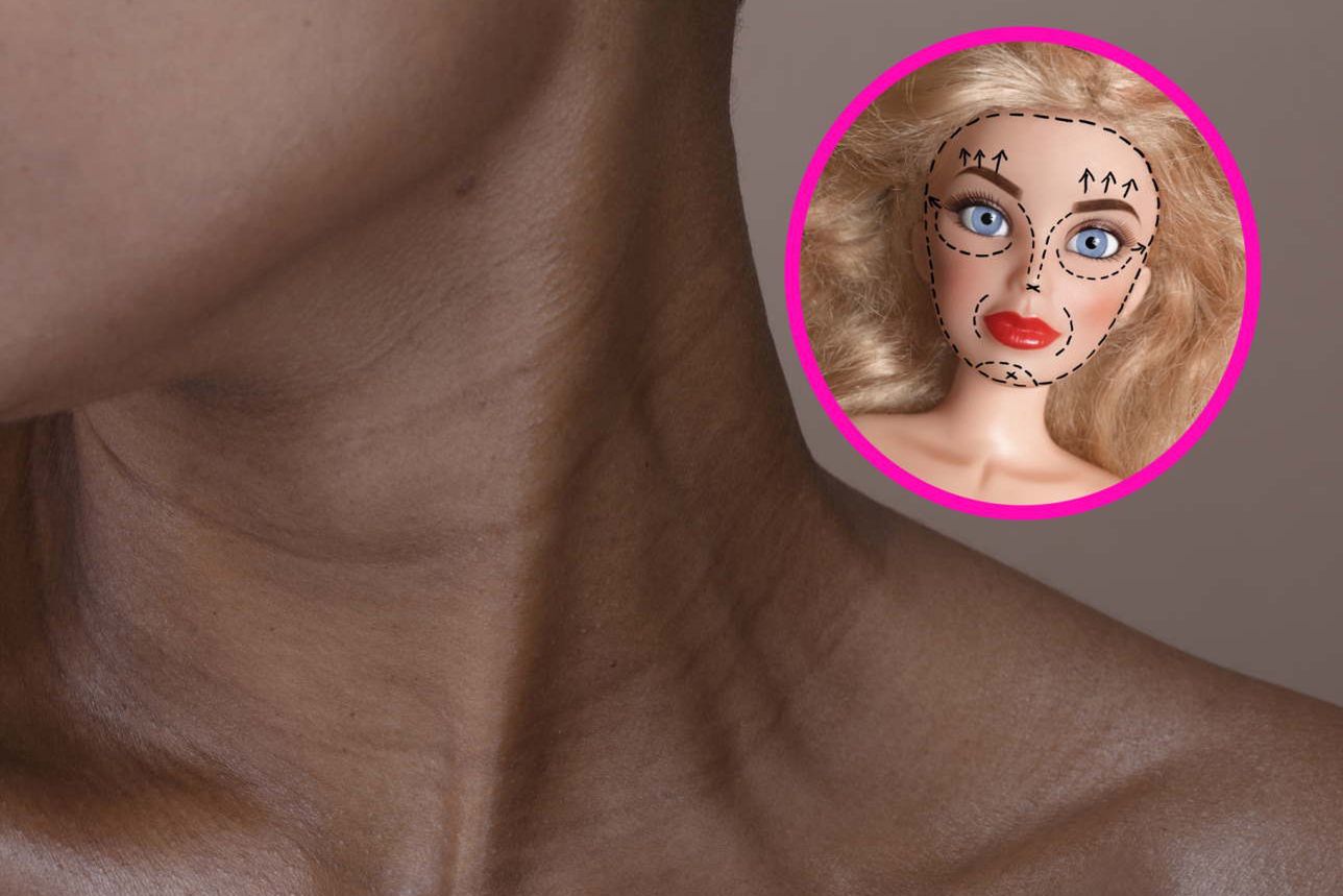 Szał na "Barbie botox". Lekarze biją na alarm