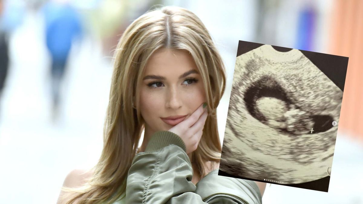 Roxie Węgiel wrzuciła do sieci zdjęcie USG. Niedawno poinformowała o związku
