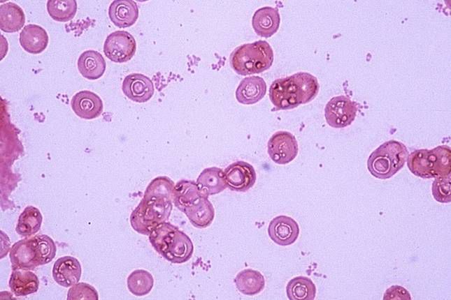 10 najważniejszych odkryć i wydarzeń naukowych lat 90. GMO, klonowanie i terapia HIV 6