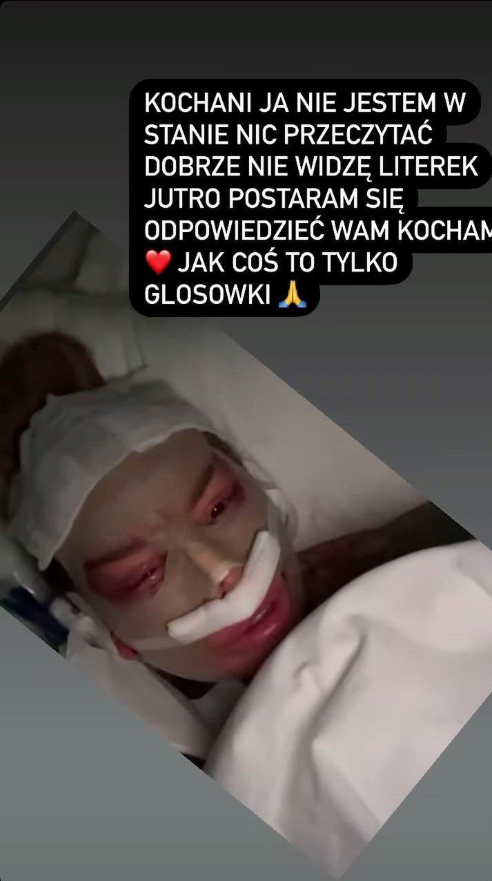 Laluna Unique pokazała się tuż po kolejnej operacji plastycznej