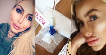 "Polska żywa Barbie" relacjonuje wypadek samochodowy na Instagramie: "Trzeba jechać po nowe usta" (FOTO)