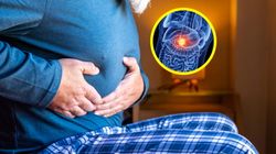 Odkryli przyczynę raka trzustki. Alarmujący wzrost zachorowań