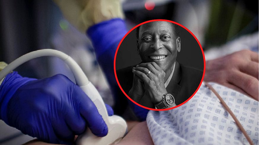 W ciągu ostatnich 30 lat nastąpiło dwukrotne podwojenie zachorowań i śmierci z powodu raka jelita grubego. To choroba, z którą walczył Pele