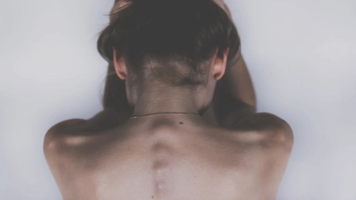 Radikulopatia nazywana również korzeniowym zapaleniem nerwu lub syndromem korzeniowym to choroba, która występuje najczęściej na skutek uszkodzenia korzeni rdzeniowych.