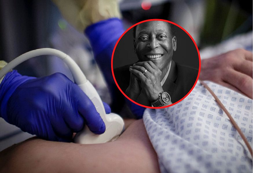 Pele zmarł na raka jelita grubego. Oto najbardziej ignorowany objaw tego nowotworu