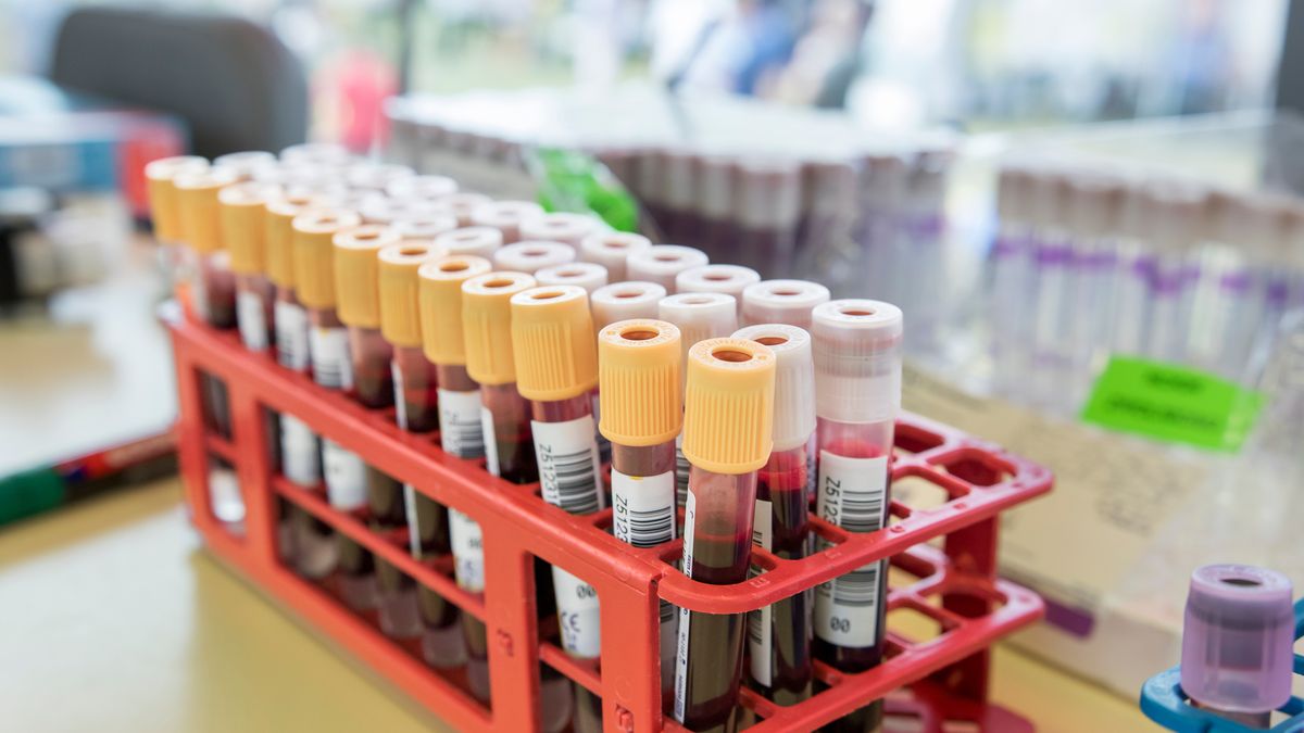 Komórki naczyń wątroby przechwytują wolną hemoglobinę