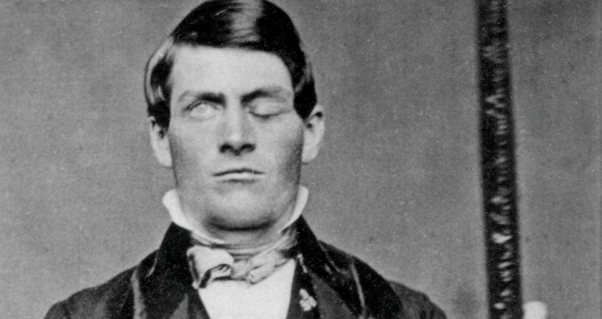 Phineas Gage 