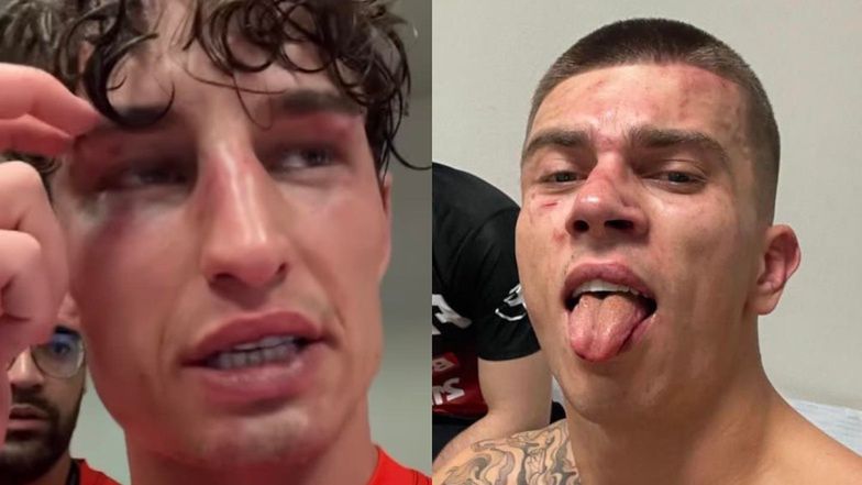 Kacper Błoński wynoszony na noszach po walce z Marcinem Dubielem