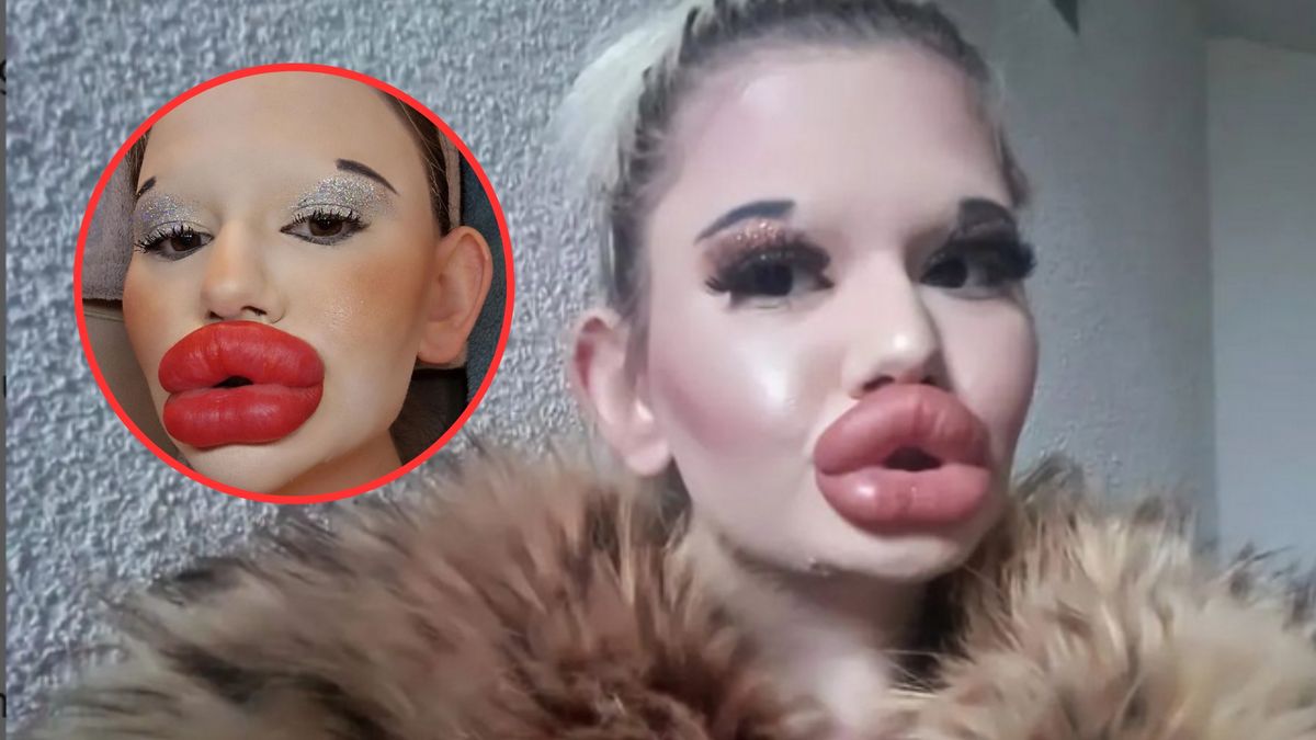 Ma największe usta na świecie, ciągle jej mało