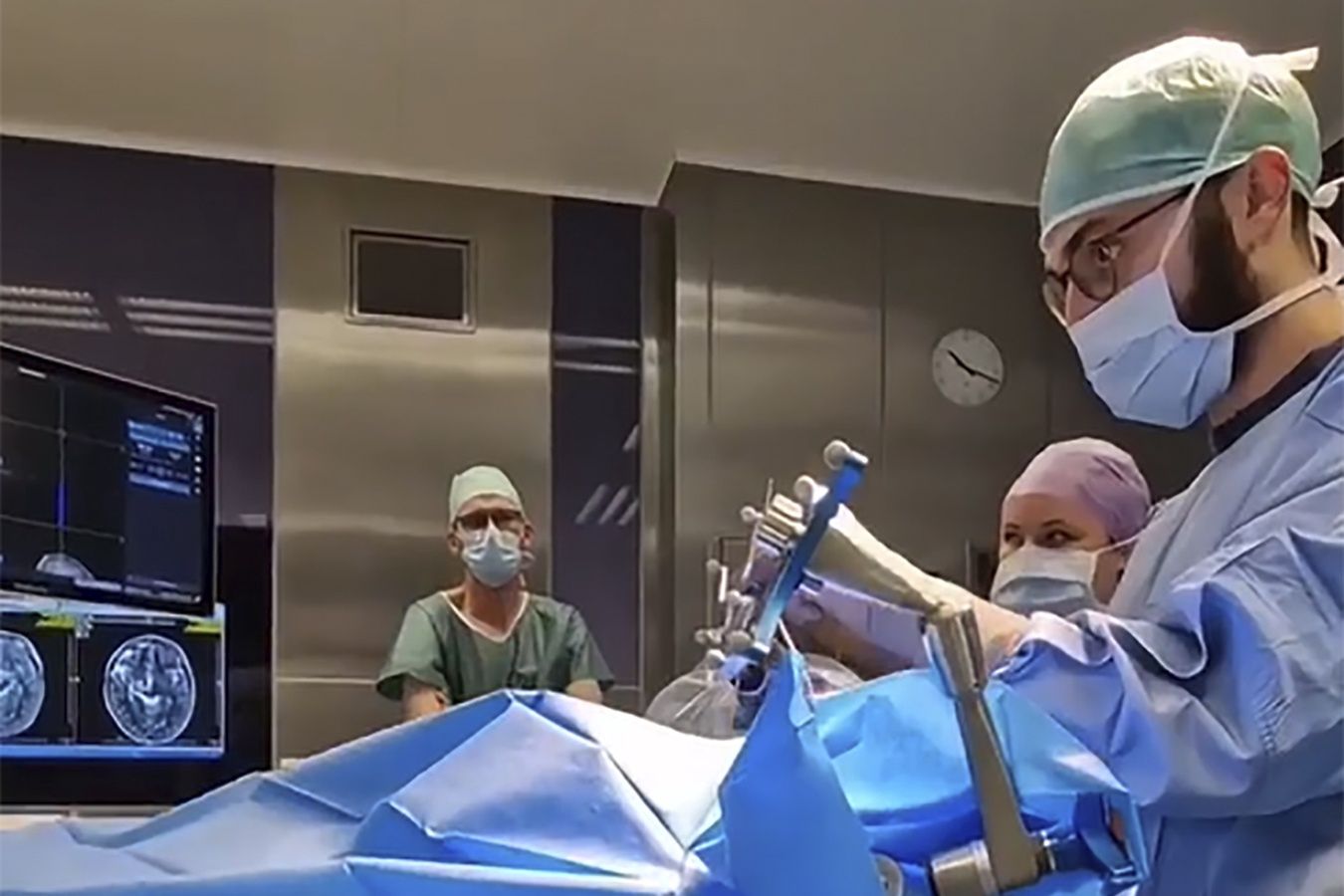 Przełomowa operacja w Polsce. Usunęli guza mózgu bez otwierania czaszki