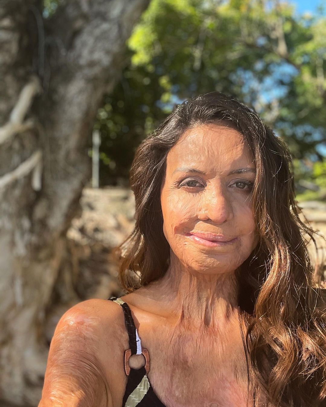 Turia Pitt