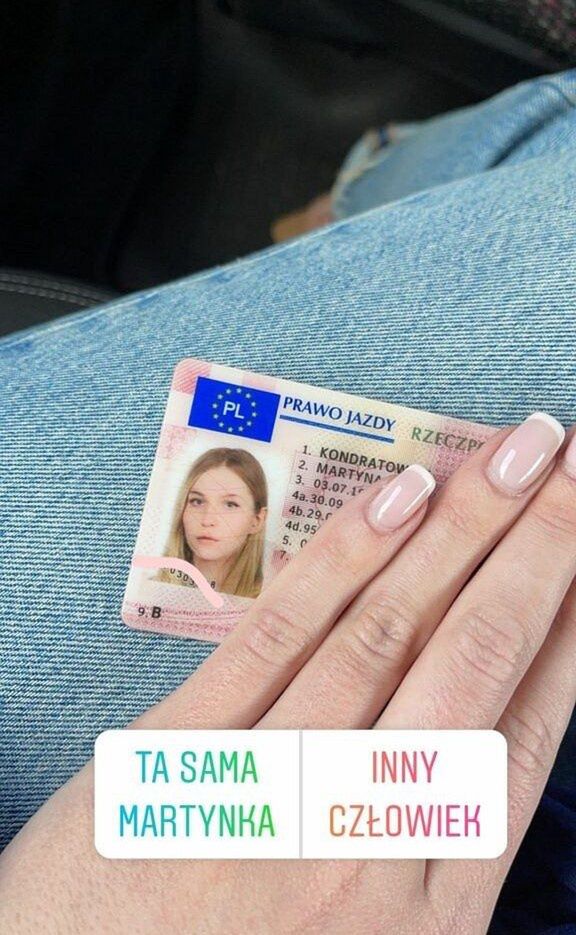 Martyna Kondratowicz pokazała zdjęcia sprzed operacji plastycznych 