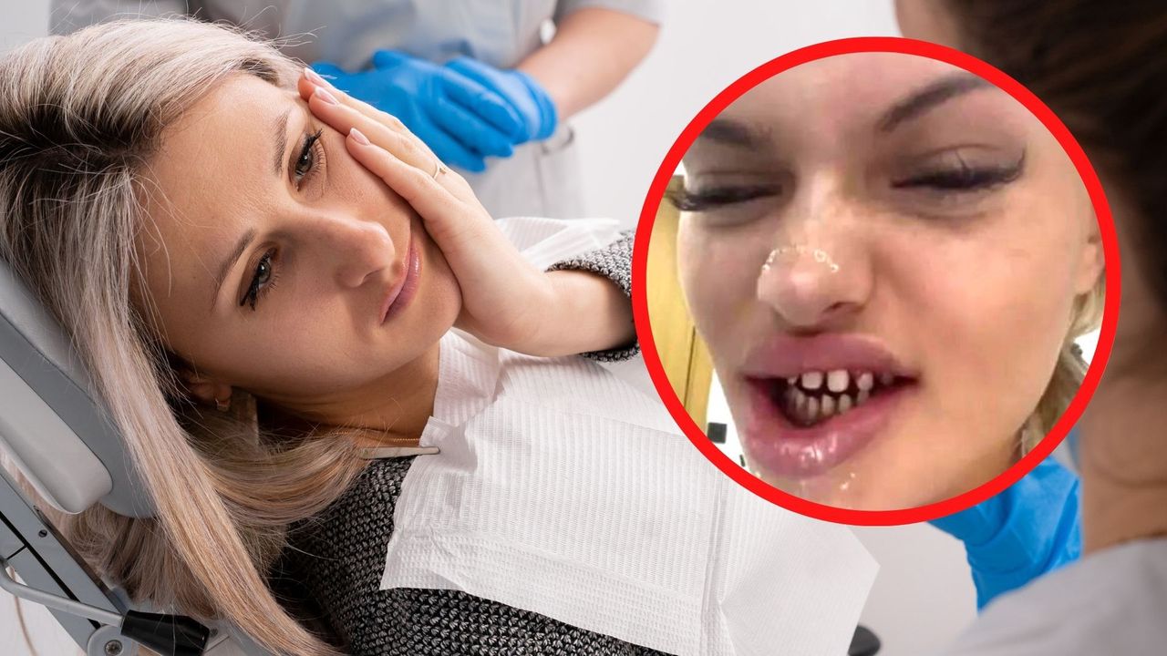 Nabrani na "tureckie zęby". Dentyści patrzą i nie wierzą