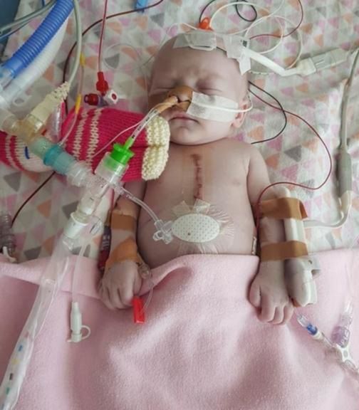Lilian tuż po urodzeniu przeszła operację na otwartym sercu