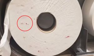 Widzisz takie ślady na papierze w publicznym WC? Lepiej uważaj