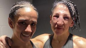 Tak wygląda twarz po 236 ciosach. Drastyczne zdjęcie