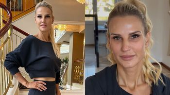 Szczuplejsza aż o 42 KILOGRAMY Dominika Tajner rozprawia o plastyce brzucha w Turcji: "Nie musiałam, ale chciałam"