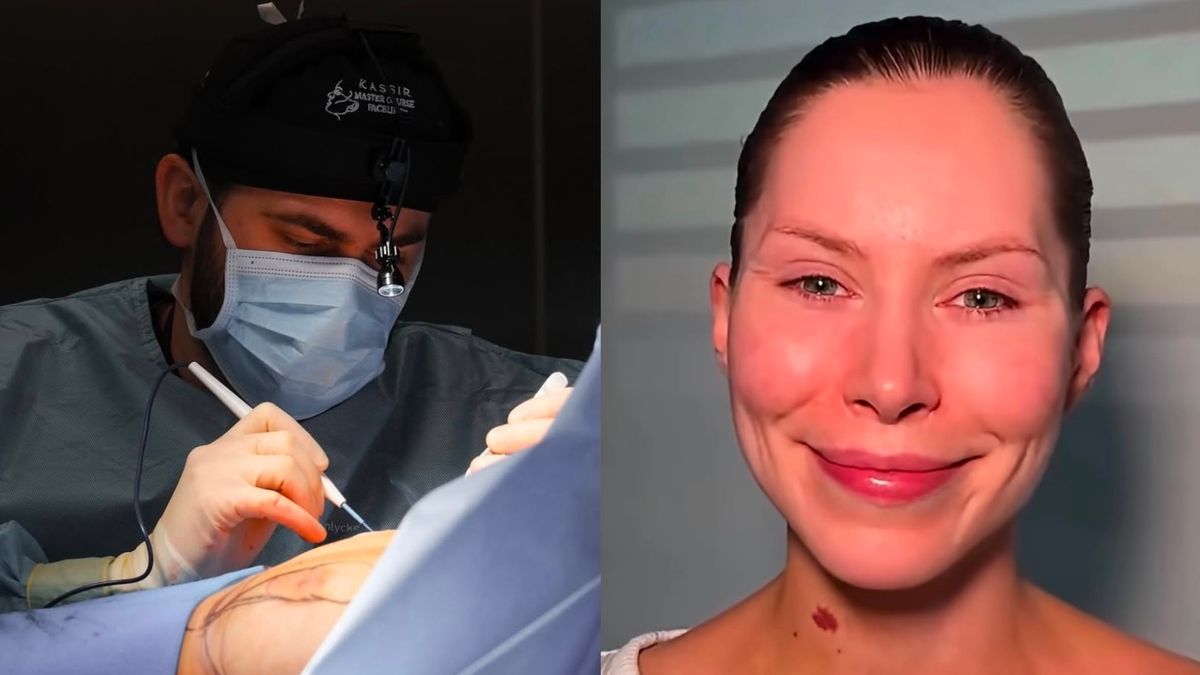 Lekarz odpowiedzialny za nieudany lifting Julii von Stein