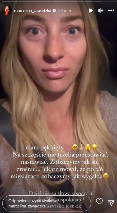 Marcelina Zawadzka miała wypadek. Co się stało? (fot. InstaStories)