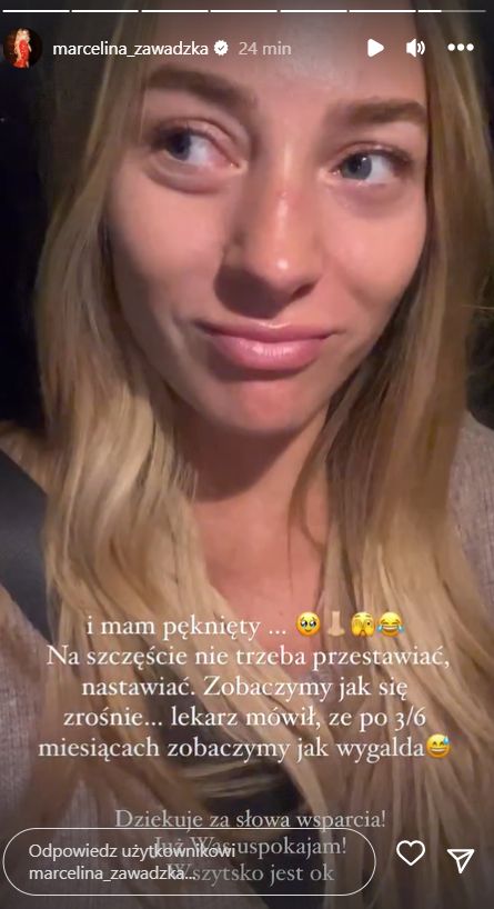 Marcelina Zawadzka miała wypadek. Co się stało? (fot. InstaStories)