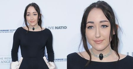 17-letnia siostra Miley Cyrus WYGŁADZIŁA I WYPEŁNIŁA TWARZ?! (ZDJĘCIA)