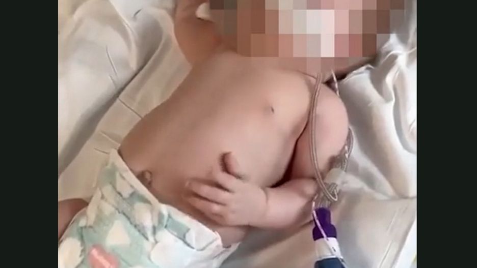 Tak atakuje wirus RSV