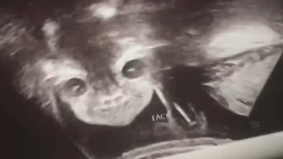 "Diabelskie dziecko" ma już 3 lata. Jak teraz wygląda?