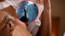 Zatyka drogi oddechowe, prowadzi do zapalenia oskrzeli i płuc. Lekarz ostrzega (WIDEO)