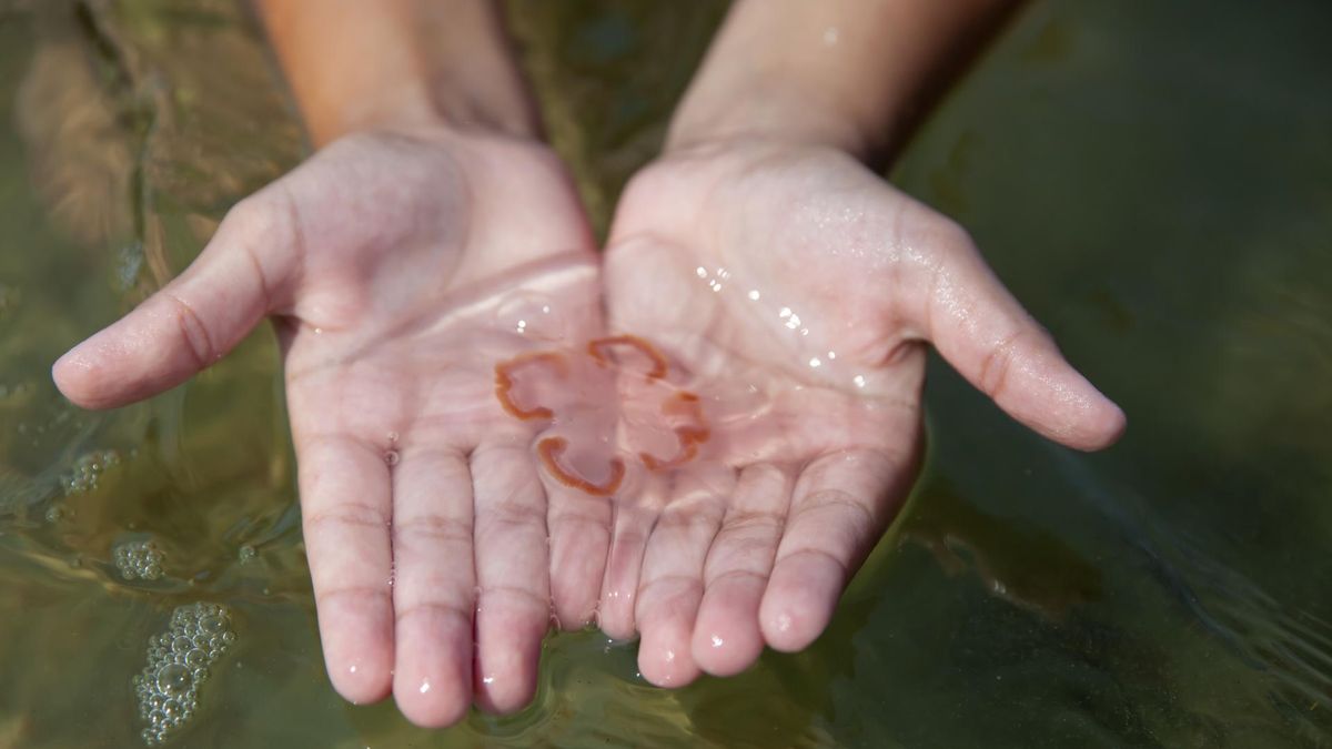 6 błędów, które możesz popełnić po oparzeniu meduzy