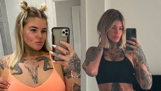 Brytyjka zrzuciła 76 kilogramów i przeszła wiele operacji w Turcji. Teraz chwali się efektami metamorfozy