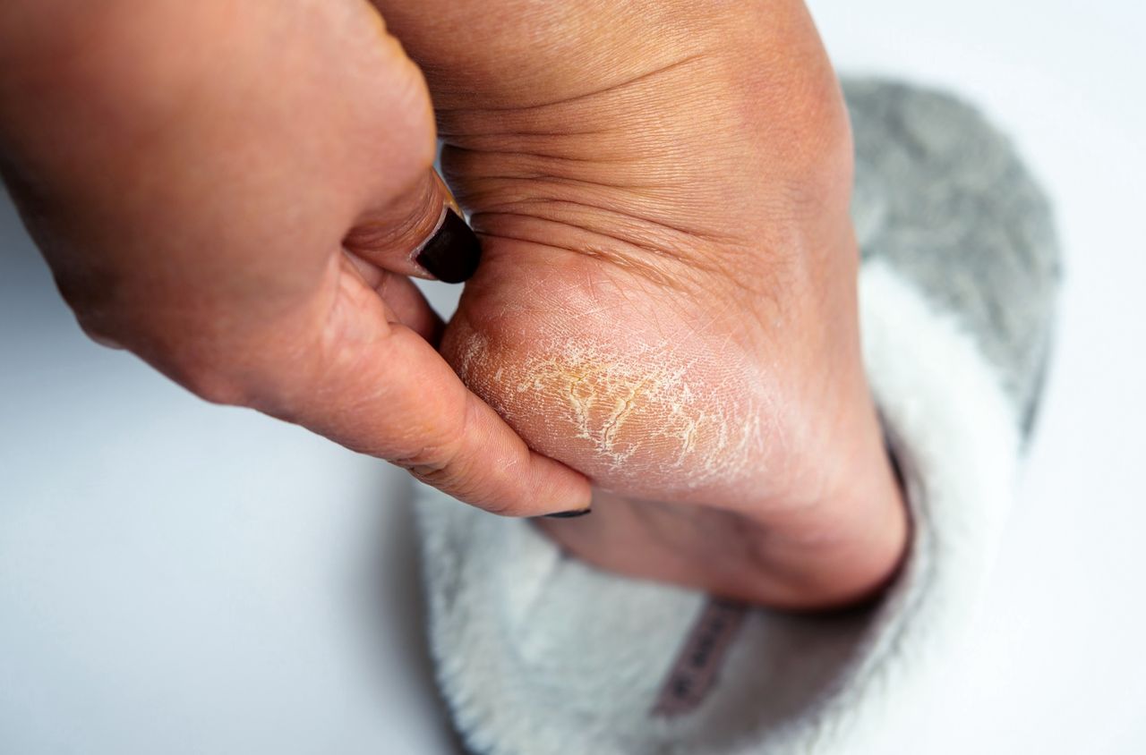 Your feet will be smoother than ever. You can make the exfoliating "mixture" yourself.