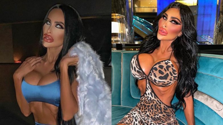 Usunęła żebra i wydała 800 tys. zł na operacje plastyczne