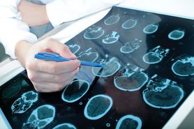 Nowotwór mózgu zniknął dzień przed operacją. Pacjent twierdzi, że to dzięki modlitwie