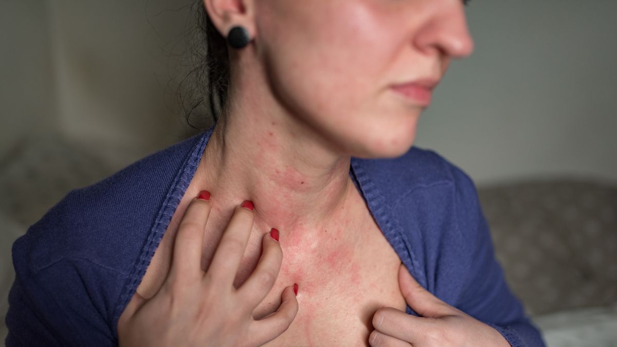 Objawy raka często pojawiają się na skórze