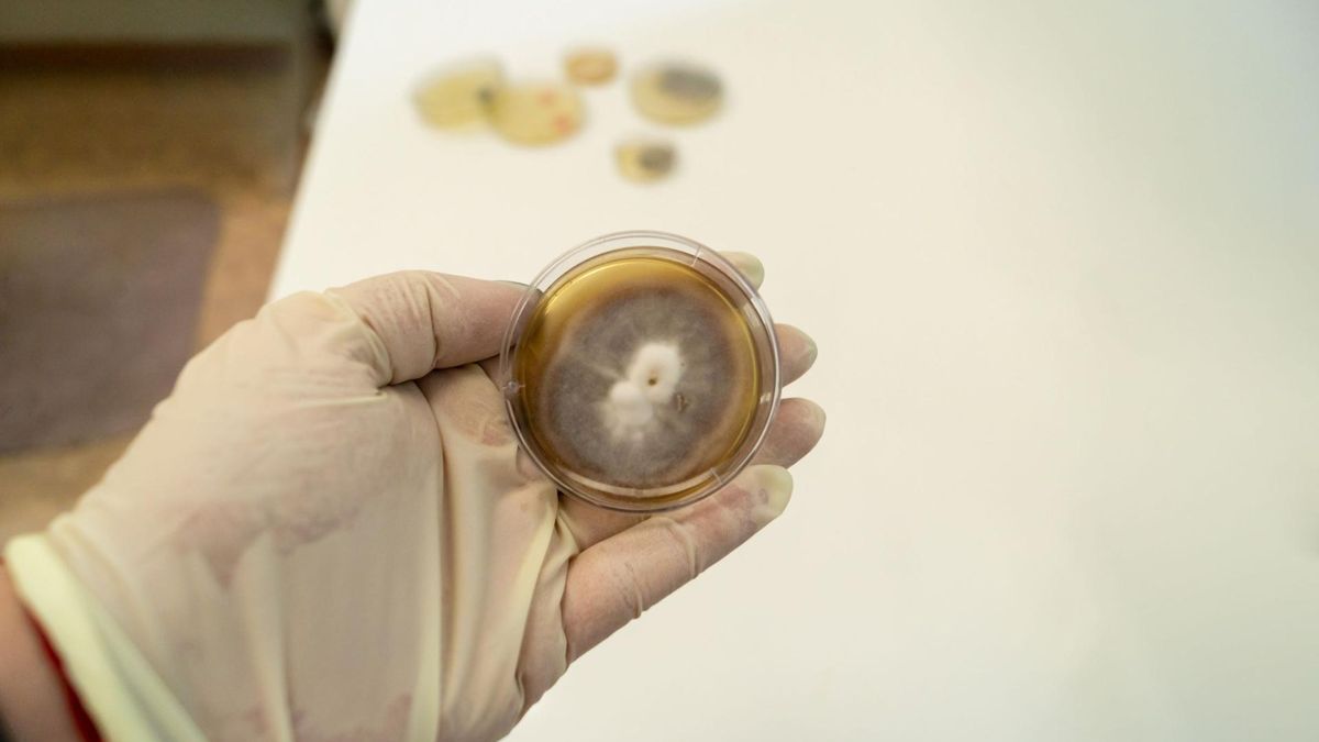 Gronkowiec skórny bywa trudny do wyleczenia, dlatego aby dobrać odpowiednie leki, wykonuje się antybiogram.