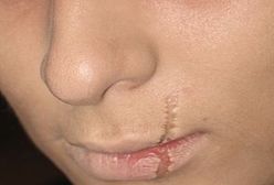 Zwalniam cię. Bo ta blizna odstrasza klientów!