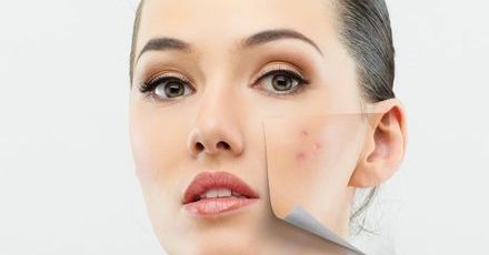 Promienna skóra bez przebarwień